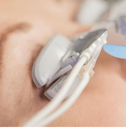 Person getting a LipiFlow treatment